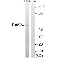 PAK2 (Ab-197) Antibody