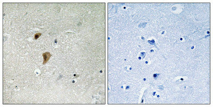 Phospho-HSF1 (Thr142) Antibody