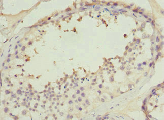 PPP2R1B Antibody