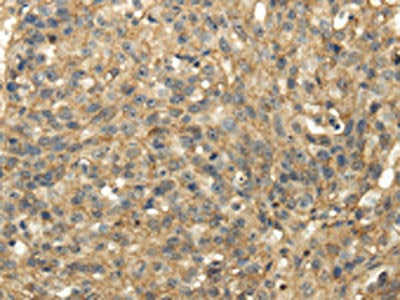 TACSTD2 Antibody