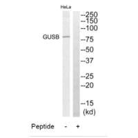 GUSB Antibody