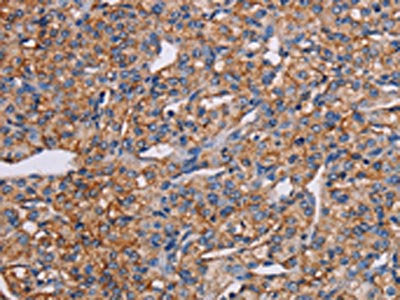 GHITM Antibody