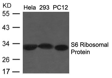 RPS6 (Ab-235/236) Antibody