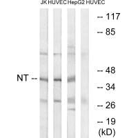 NTM Antibody