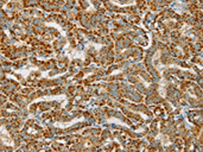 PDP1 Antibody