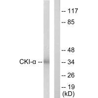 CSNK1A1 Antibody