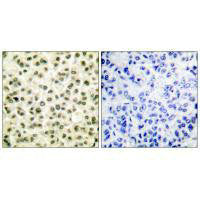 XRCC6/XRCC5 Antibody