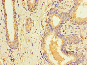RFK Antibody