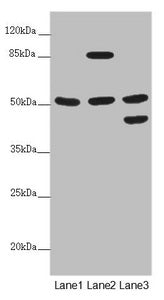 PPP2R3C Antibody