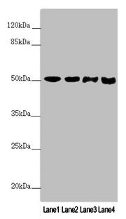 PPP2R3C Antibody