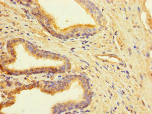 CLUAP1 Antibody