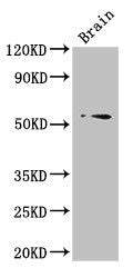 TRIM43 Antibody