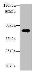 RPUSD4 Antibody