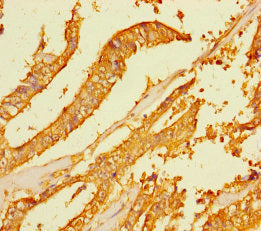 FAM167A Antibody