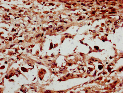 NSMCE2 Antibody
