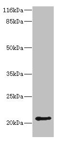 HDDC3 Antibody