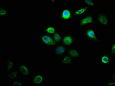 DHRSX Antibody