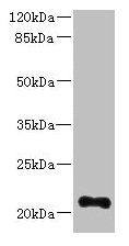 TTC9C Antibody