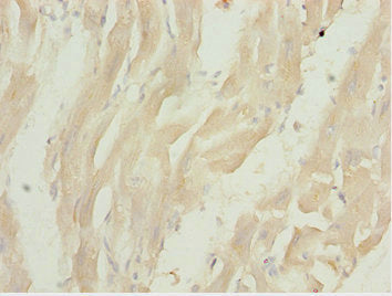 LZTR1 Antibody
