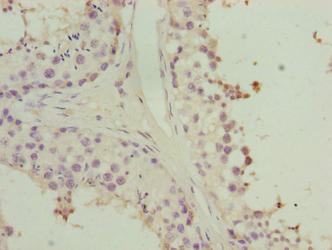 HORMAD2 Antibody