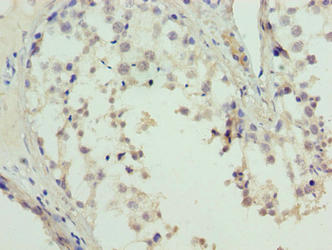 L3MBTL4 Antibody