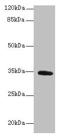 SETD9 Antibody