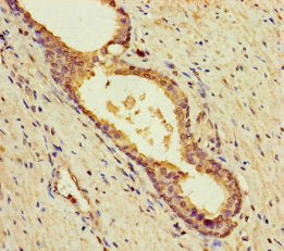 BLOC1S5 Antibody