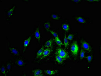 SLC38A5 Antibody