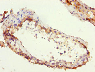 ZCCHC13 Antibody