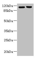 RPGR Antibody