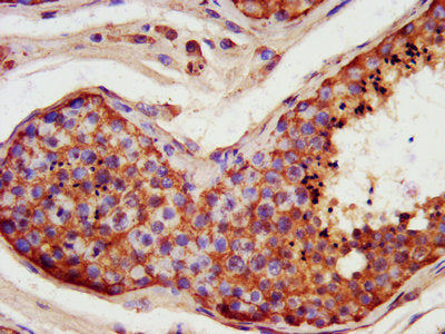 FATE1 Antibody