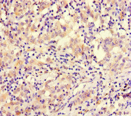 SMARCE1 Antibody
