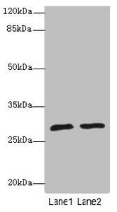 APIP Antibody
