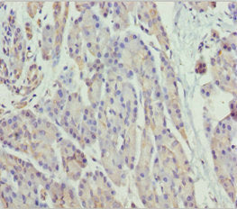 SCYL1 Antibody