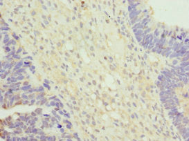 VPS35 Antibody