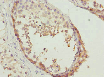 TESK2 Antibody