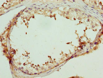 LRRC18 Antibody