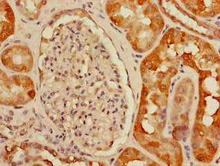 USHBP1 Antibody