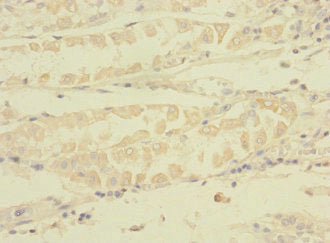 TNRC6A Antibody