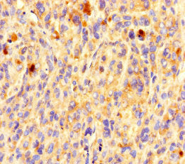 OR5L1 Antibody