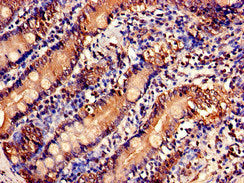 USP6NL Antibody