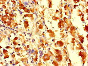 CDS1 Antibody