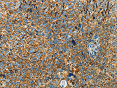 BCAT2 Antibody