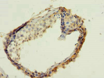 WBP2 Antibody