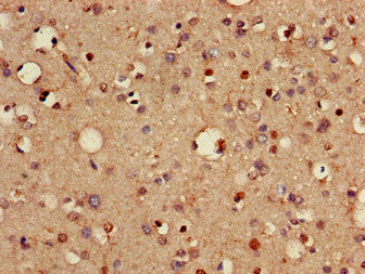 VTI1A Antibody