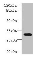 CCDC127 Antibody