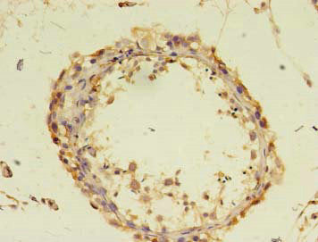 DOCK10 Antibody