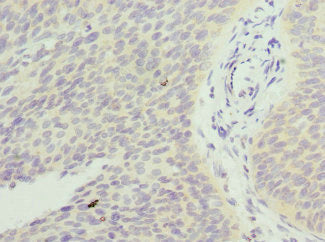 FXYD5 Antibody