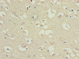 CMTM5 Antibody