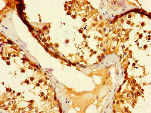 DUS3L Antibody